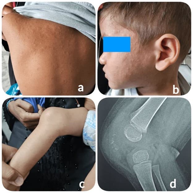 ACR Convergence 2025 Image Competition Winner