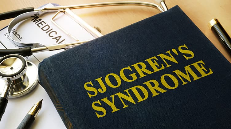 Sjögren’s Syndrome